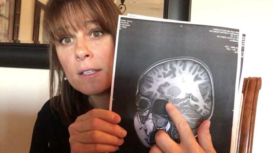 Nicole's Story of Her Son's Miraculous Healing - Body Healing, Testimonies - Kerri Pomarolli