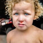 Toddler with curly blond hair and blue eyes, nose bleeding slightly, standing shirtless in a dim garage with cars in the background.