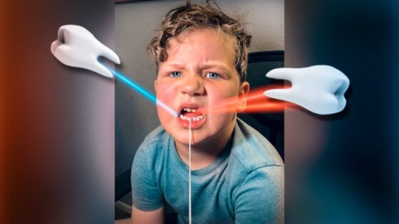 Boy sitting in a chair makes a surprised face as blue and red laser beams pass by his mouth, with white cartoon hands on either side of the image.