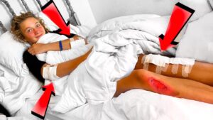 Young person lying in bed with blankets up, smiling, and visible injuries: a red, irritated leg wound with tape on the knee and arm bandages; red arrows highlight the injuries across the body.