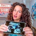 Woman with curly hair holding an ultrasound photo in a cluttered, colorful bedroom; bold video title reads 'FIRST ULTRASOUND WITH MY 5 KIDS' in red letters.