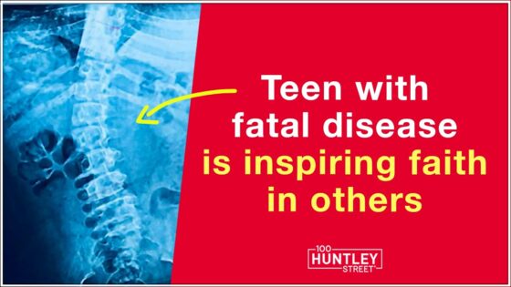 Teen with fatal disease is inspiring faith in others ‣ Witness21