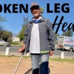 Broken leg healed after praying | FAITH ‣ Witness21