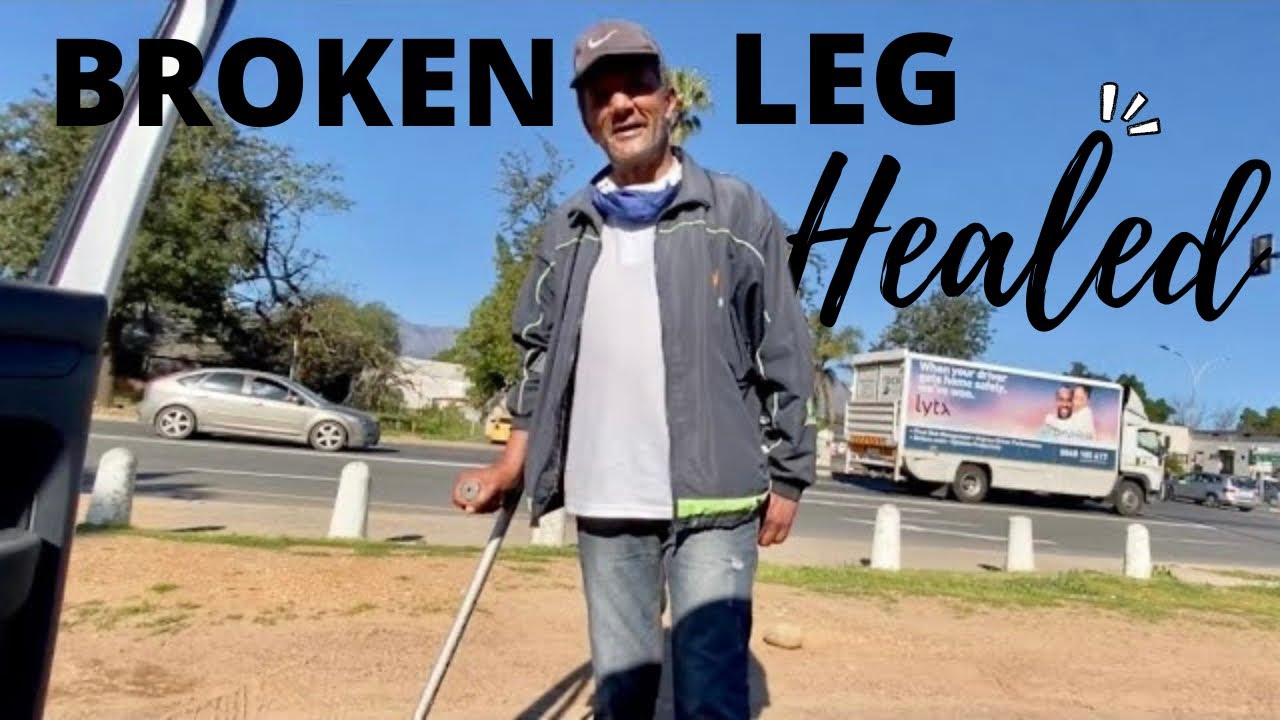 Broken leg healed after praying | FAITH ‣ Witness21