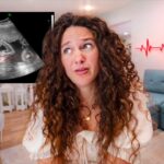 Woman with curly hair looks surprised while an ultrasound image is overlaid in the top-left corner of a living room scene; a red heartbeat line decorates the wall behind her.