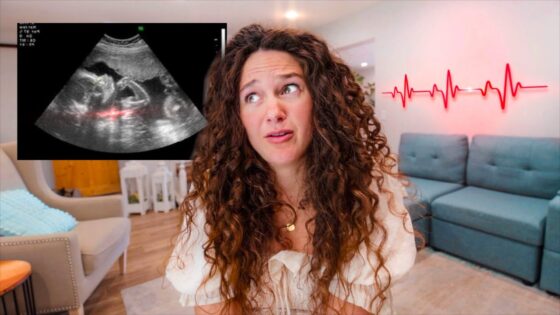 Woman with curly hair looks surprised while an ultrasound image is overlaid in the top-left corner of a living room scene; a red heartbeat line decorates the wall behind her.