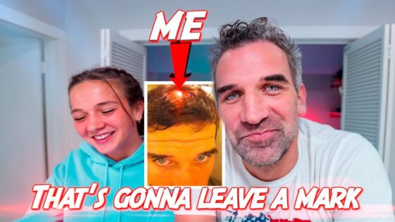 Smiling couple in a thumbnail; inset shows a man’s forehead with a red light, labeled ME, captioned 'That’s gonna leave a mark'.