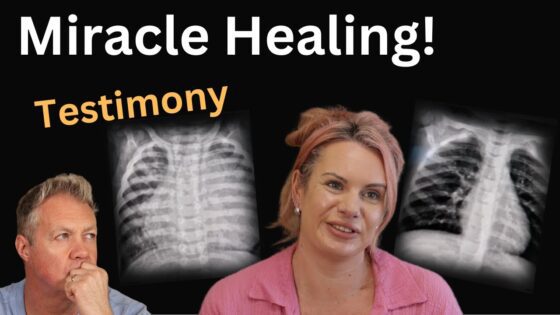 Miracle Healing! Witness God's Power And Prophetic Word ‣ Witness21