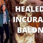 Healed of Alopecia Universalis and Baldness – Allyson Rola ‣ Witness21