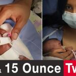 World’s Most Premature Twins: We Believed God for a Miracle - Family & Relationships, Pregnancy Complications, Testimonies - 100huntley