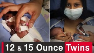 World’s Most Premature Twins: We Believed God for a Miracle - Family & Relationships, Pregnancy Complications, Testimonies - 100huntley